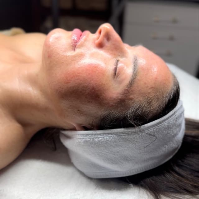 The Luxe Skin Series at Luxe Complexion Aesthetics in Jupiter, FL